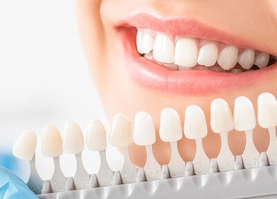 「もっと歯を白くしたい」という方には、ご自宅と医院で行う「デュアルホワイトニング」を提案しています