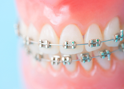 ご自身の歯並びだけでなく、虫歯やお子さまの矯正など様々なご相談に対応しています。