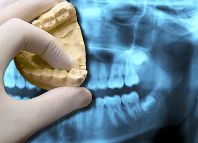 歯科口腔外科を深く学んだ歯科医師が在籍。まずはご相談ください。