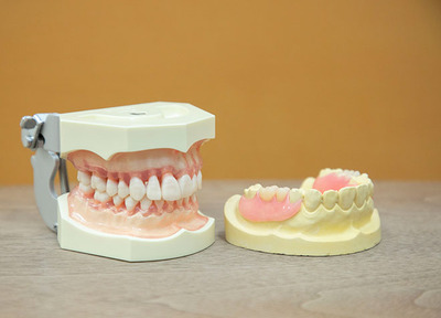 岡本歯科クリニック 入れ歯・義歯