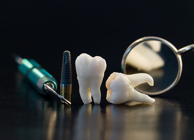 歯科口腔外科を深く学んだ歯科医師が治療を行います