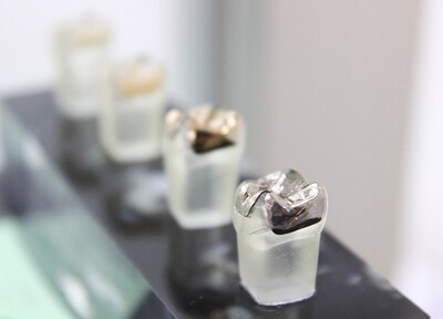 堀川歯科クリニック 入れ歯