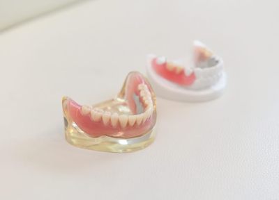 おまつ歯科 入れ歯・義歯