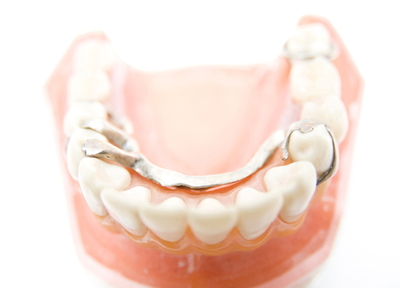 入れ歯治療は、痛みが少なくて外れにくく、楽しく食事ができる状態を目指します