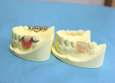 名古屋歯科口腔外科 入れ歯・義歯