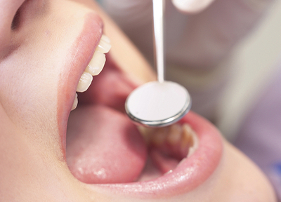 唾液検査の結果を参考にして、患者さまの口内環境に合った予防方法をご提案します