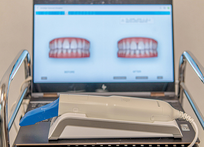 スムーズに歯型が取れる、デジタル印象採得装置を導入しています