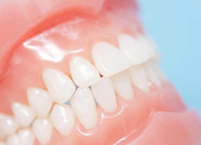 歯の矯正は見た目だけでなく、歯の健康のために行う治療です
