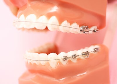 としかわ歯科医院 矯正歯科