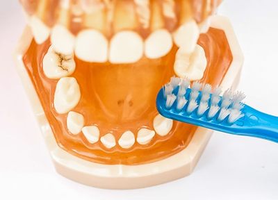 立浪歯科クリニック 予防歯科
