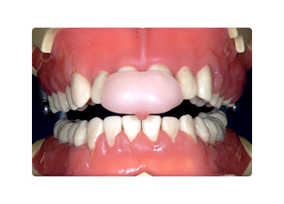 五十嵐歯科クリニック 顎関節症