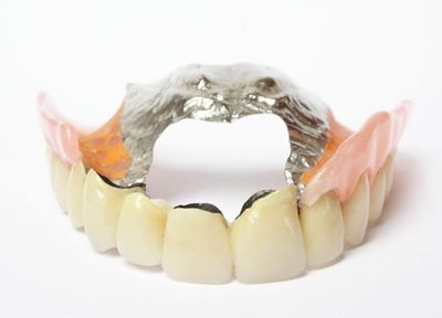 薄く違和感の少ない金属床の入れ歯を使用することで、さまざまなメリットがあります