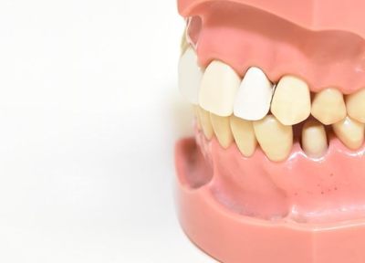 金属を使わず奥歯のかぶせ物ができるジルコニア。セラミックと組み合わせてノンメタルで治療。