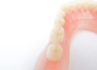 小さな虫歯には、患者さまに合わせて適したつめ物による治療を行っていきます