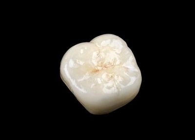 オールセラミックのかぶせ物・つめ物は、自然な見た目で歯に優しく、高い耐久性を持っています