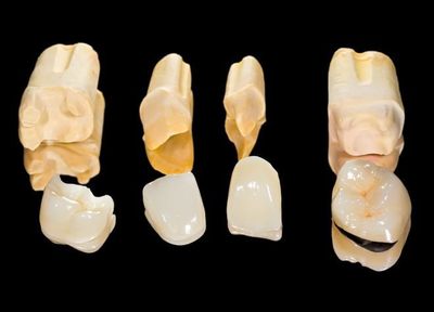 患者さまのご希望や事情をお伺いし、ご相談の上で適した材質をご提案しています。