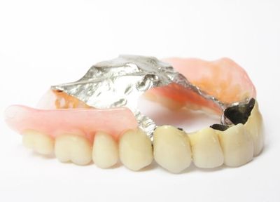 入れ歯の違和感を強く感じる方へ。「金属床義歯」は衛生的で違和感の少ない入れ歯です