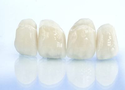 歯の形や色でお悩みの患者さまにはラミネートベニアの施術も可能です。