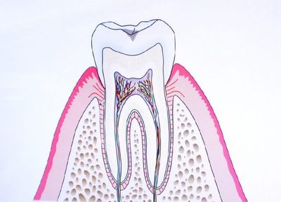 歯周病と一緒に虫歯も治療。トータルな見方でお口の環境を良い方向へ、歯の健康を守っていきます