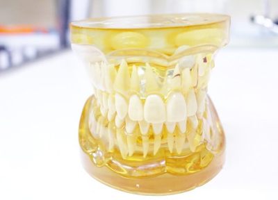 虫歯予防をするためには早期発見・早期治療が大切。さまざまな機器を導入して診査をしています
