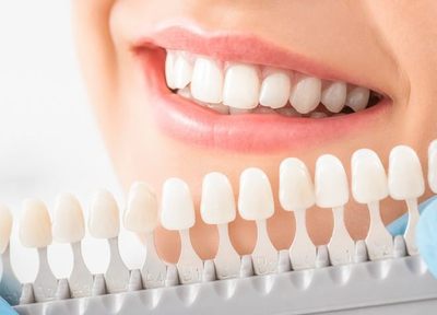 Q.歯をより白くしたい方には、どのような治療をご提案していますか？