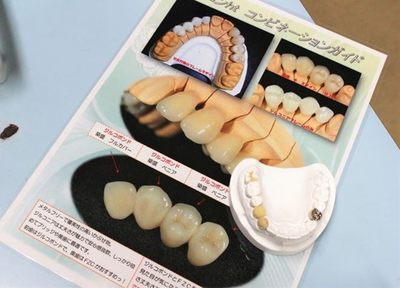島田歯科医院 つめ物・かぶせ物
