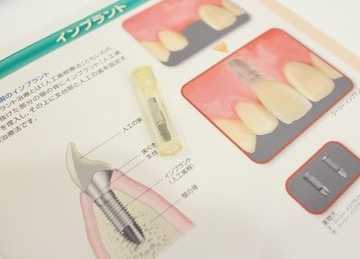 阪本歯科医院 予防歯科