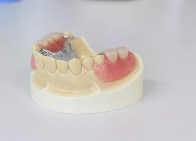 小髙歯科医院 入れ歯・義歯