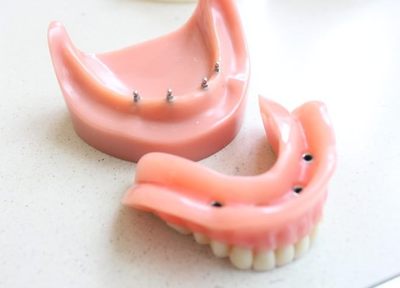 白川歯科医院 入れ歯・義歯