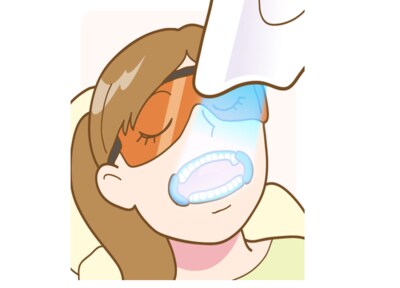 オフィスホワイトニング（※）