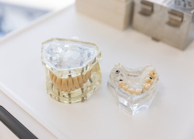 名古屋歯科 入れ歯・義歯