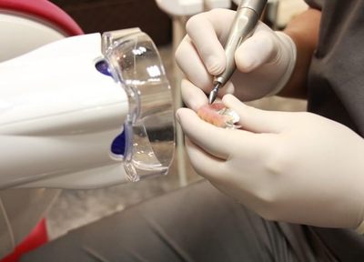 Q.入れ歯を長持ちさせるための取り組みはありますか？