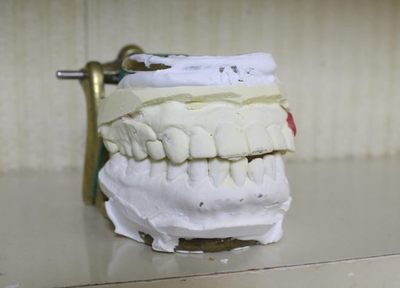 韋歯科医院（いしかいいん） 入れ歯・義歯
