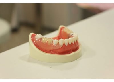 ほうたつ歯科医院 入れ歯・義歯