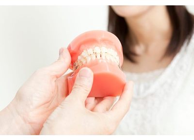 矯正を担当する歯科医師によるサポート