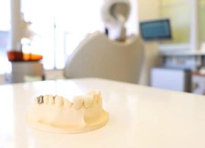 ほんだ歯科クリニック つめ物・かぶせ物