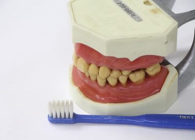 知らない間に進行して歯を失う原因である歯周病は、歯科医師が原因菌を取り除き歯を守ります