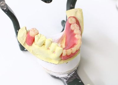 Q.入れ歯に関する要望は聞いてもらえますか？