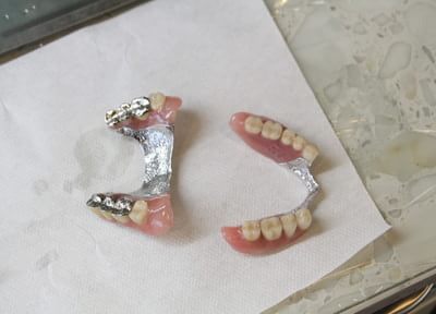患者さまが納得できる入れ歯をつくるために、まずは仮の義歯で調整を