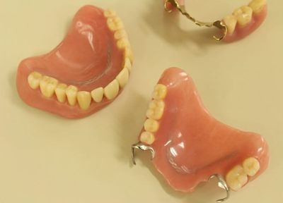 技工所との連携で、口にぴったり合うように入れ歯を製作いたします