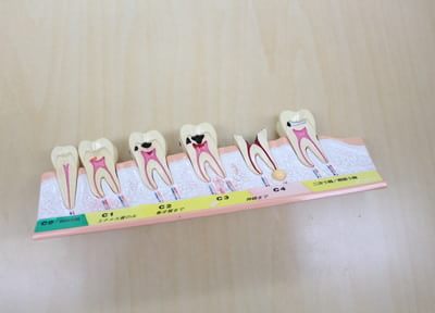 歯の健康には院内でするケアとセルフケアの両方が大事です