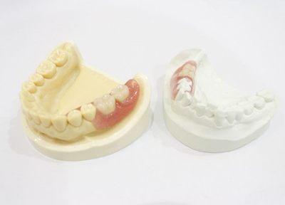負担の少ない入れ歯ならしっかりと噛め、唾液の分泌も促されます