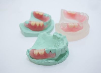 歯を失った際の治療は、それぞれの治療のメリット、デメリットをご説明いたします