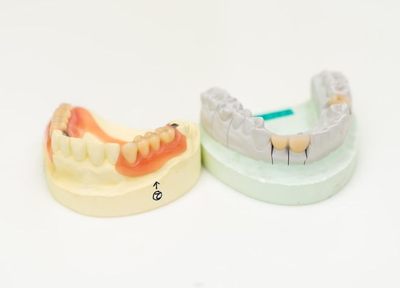 Q.入れ歯作りの際、気を付けていることは何ですか？