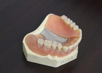 黒住歯科医院 入れ歯・義歯