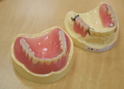 当院は、患者様のお口に合った入れ歯の製作につとめております。