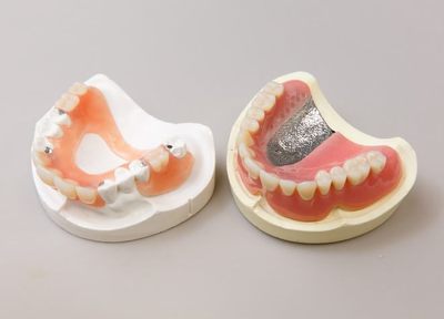 Q.入れ歯治療で大切にしていることは何ですか？