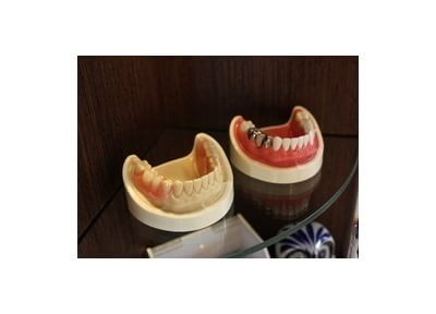 みやべ歯科クリニック 入れ歯・義歯