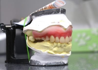 アマリ歯科クリニック 入れ歯・義歯