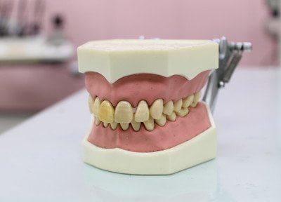 Q.入れ歯・義歯治療で心がけていることはありますか？